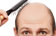 Low-level Laser Therapy for stopping Hair Thinning